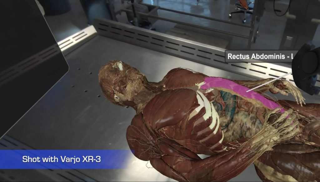 VR and XR in Medical Training; Toltech